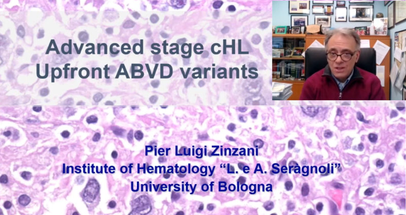 Advanced-stage cHL: Pro up-front ABVD variants