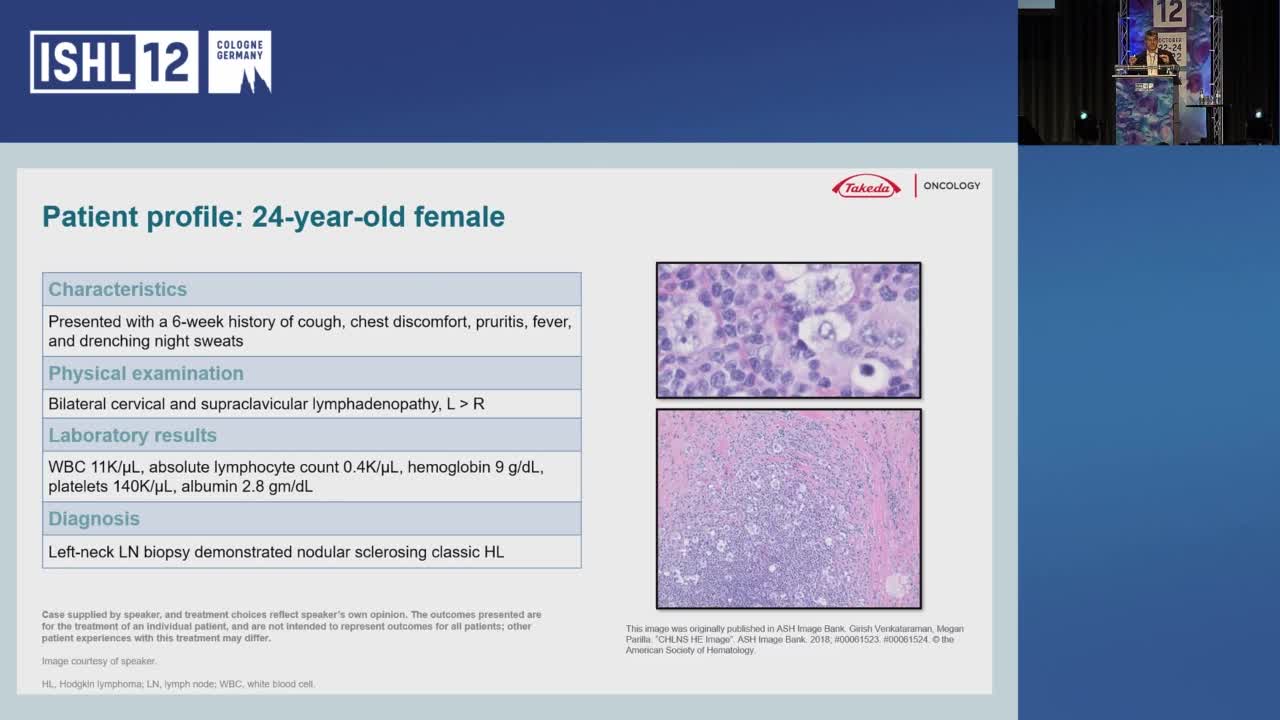 Hot off the press: The latest data for the frontline treatment of patients with Stage IV CD30+ Hodgkin Lymphoma from ECHELON-1