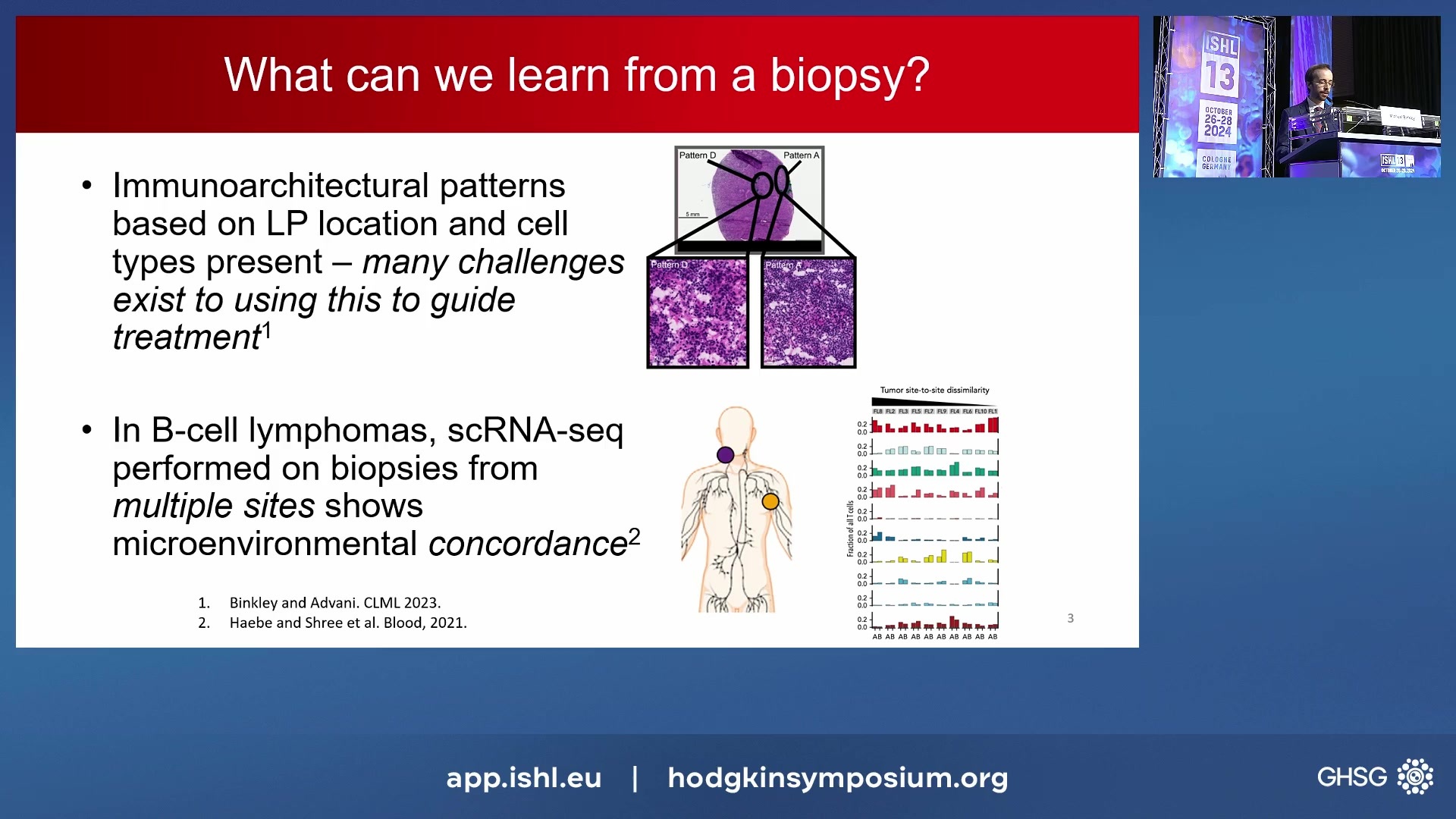Distinct cell state ecosystems for nodular lymphocyte-predominant Hodgkin lymphoma