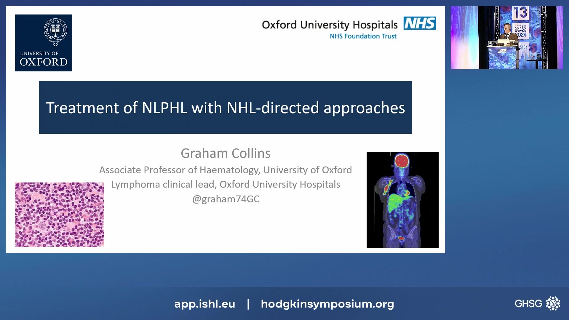 Treatment of NLPHL with NHL-directed approaches
